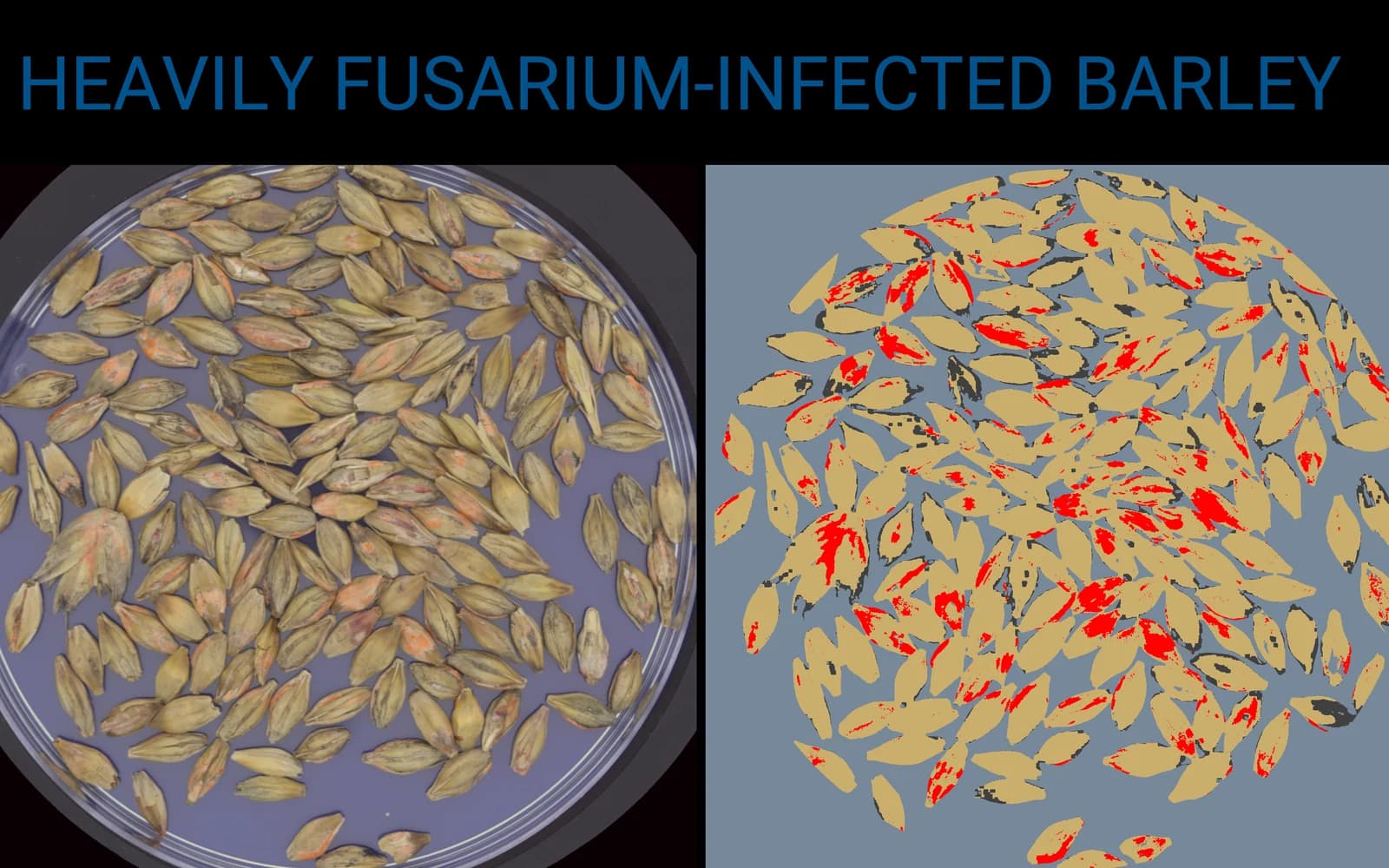 Cevada com infecção severa por Fusarium, grãos afetados destacados